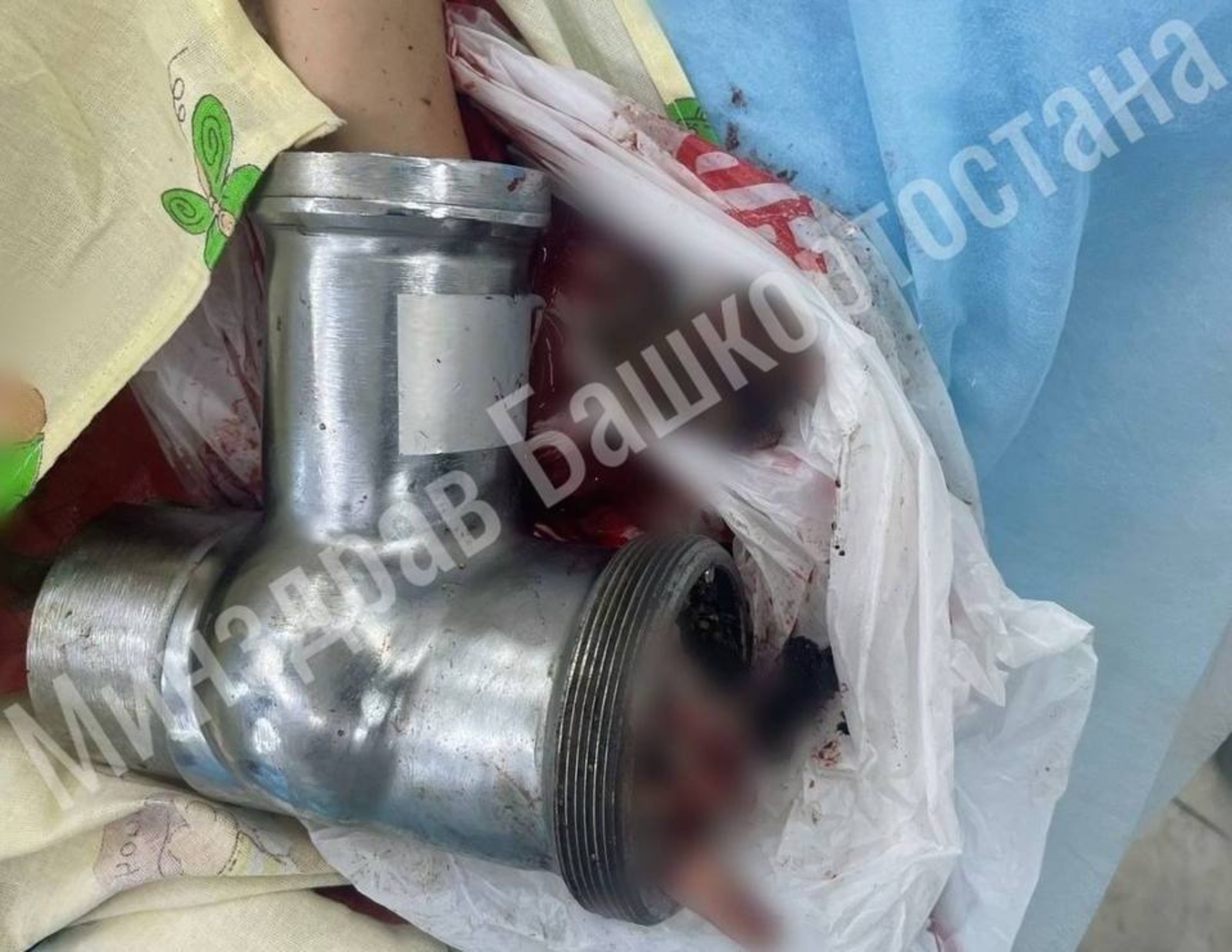 Teiegram, личная страница Айрата Рахматуллина.