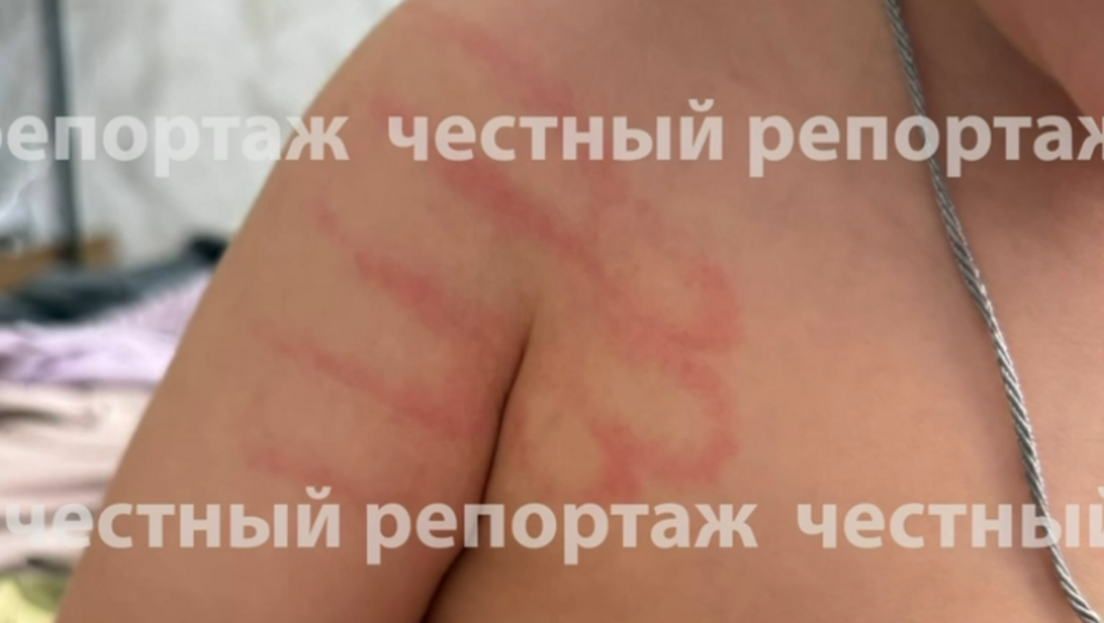 «Честный репортаж». ТГ-канал «Честный репортаж».