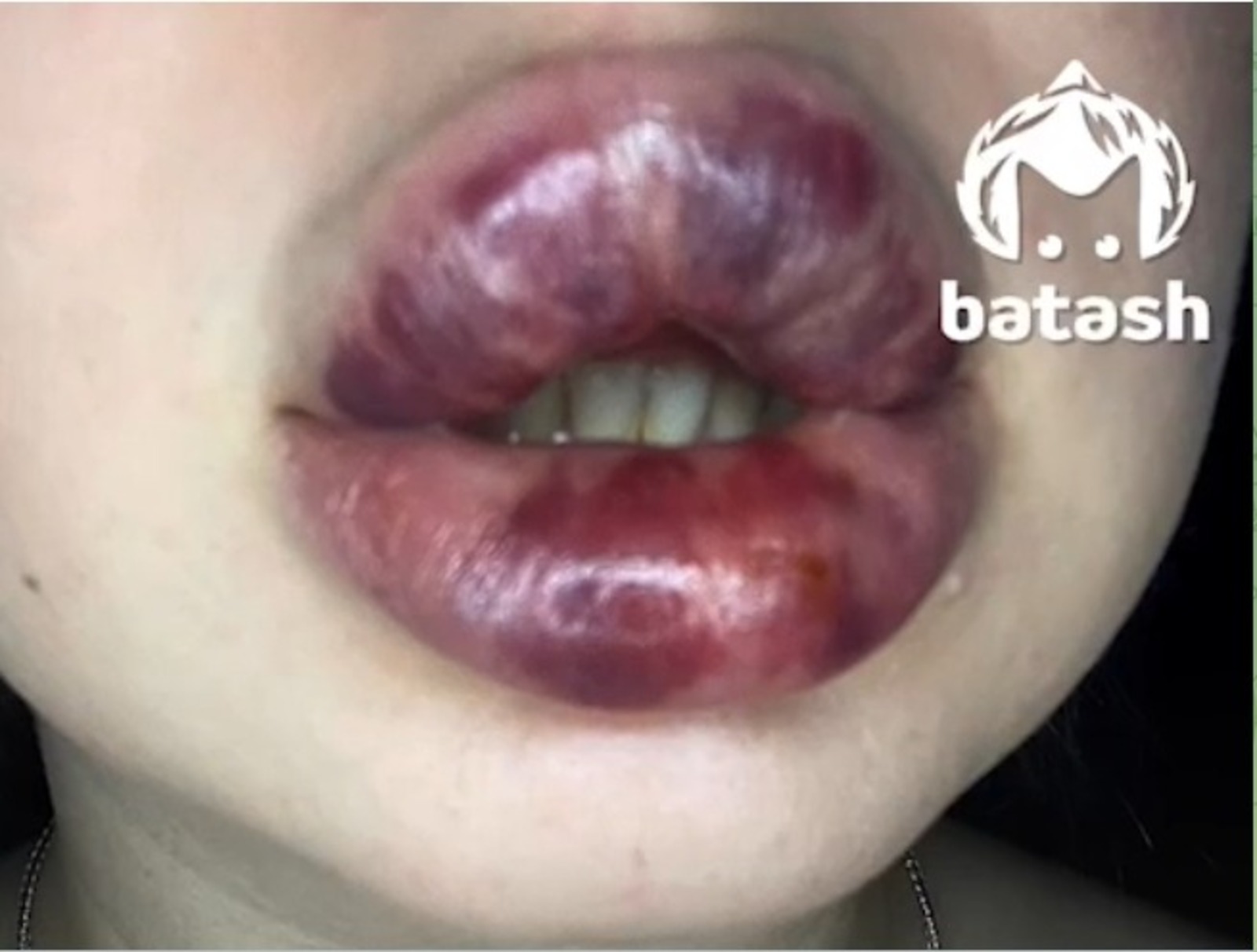 телеграм-канал Mash Batash. скриншот видео.