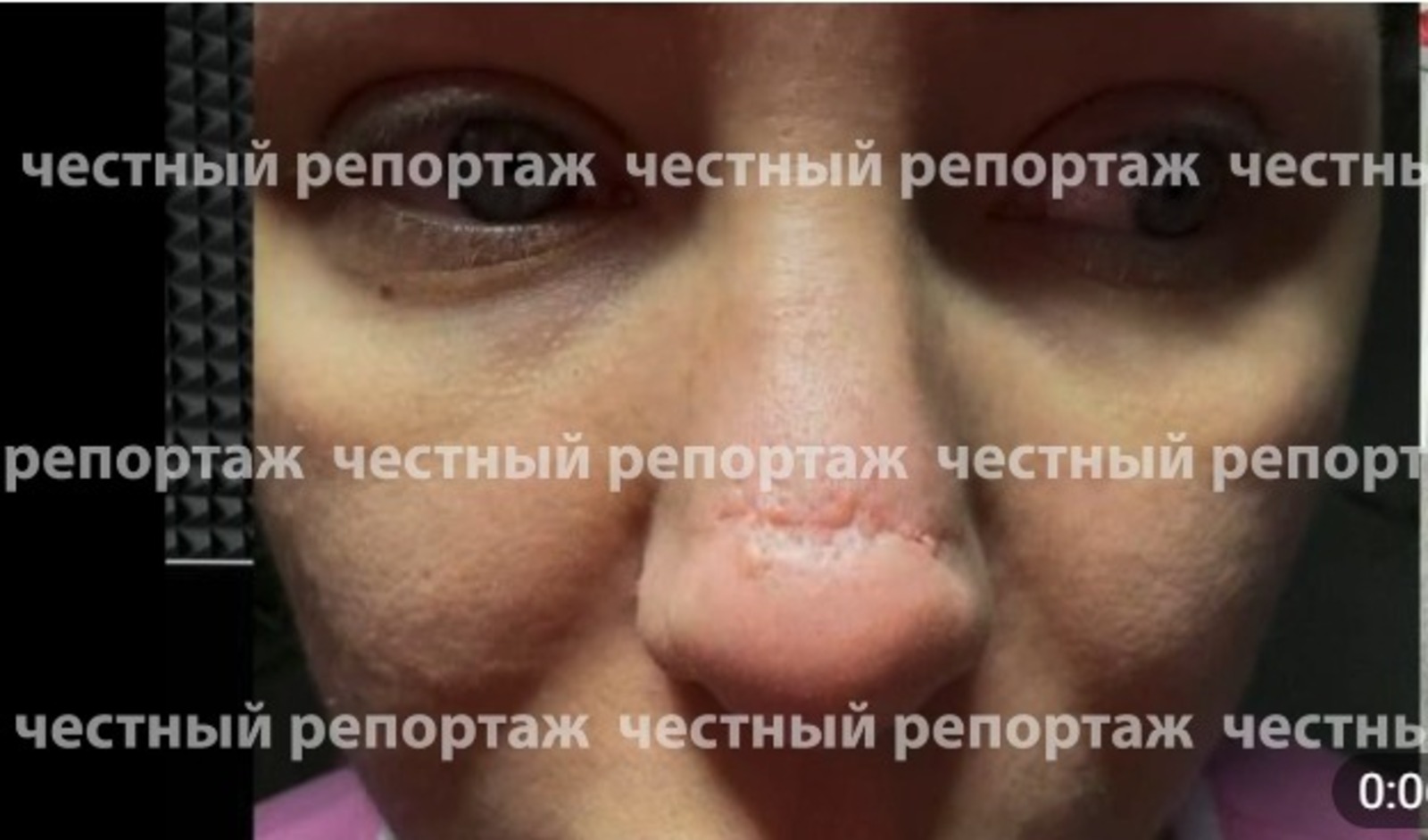 тг-канал «Честный репортаж». тг-канал «Честный репортаж».