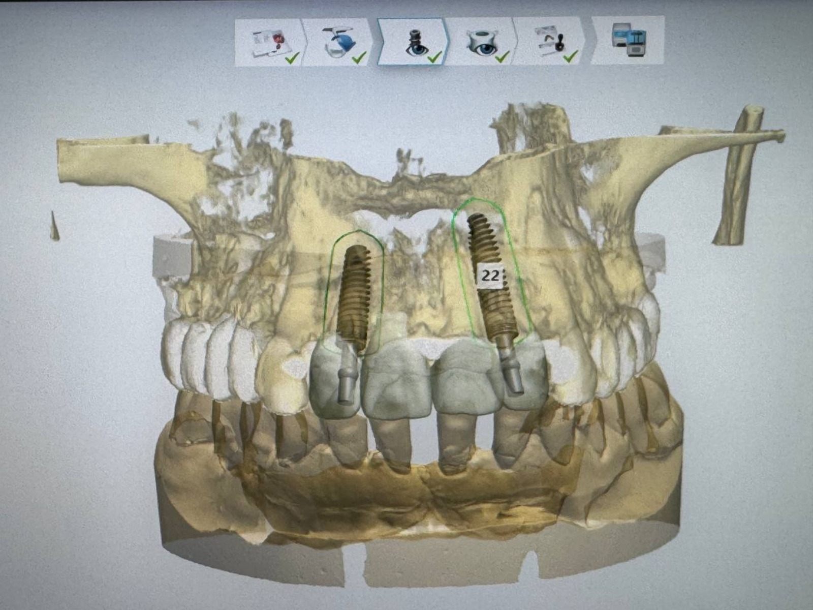 официальная страница Айрата Рахматуллина. Telegram.